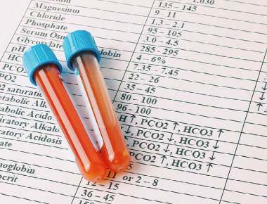 1961 20210816 115308 Blog Calculatingmap Mobile (1)